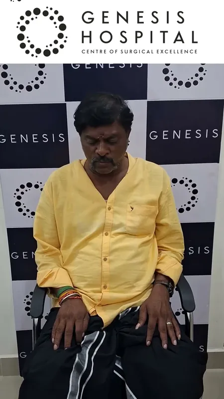 Varicose vein pain gone after EVRF treatment, real patient story
